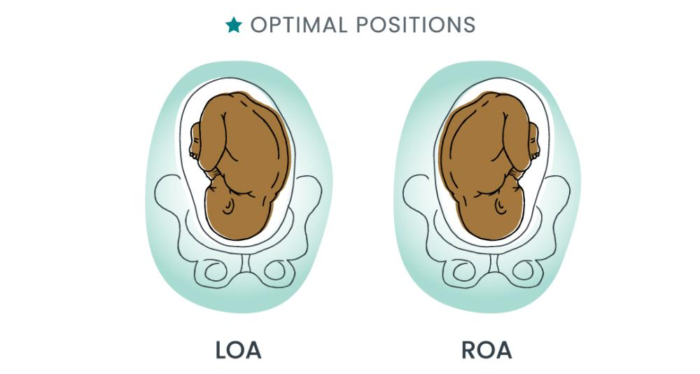 Illustration of baby in Left Occiput Anterior (LOA) and Right Occiput Anterior (ROA) fetal birthing positions