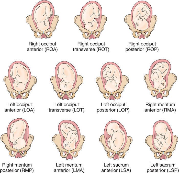 what is the normal presentation of the infant at birth